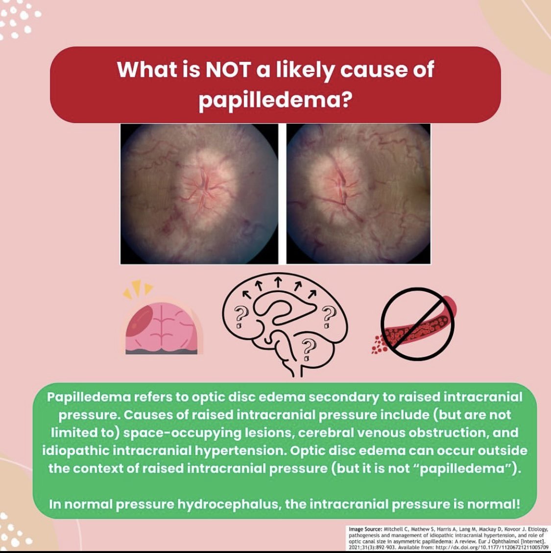 EyeCurriculum's tweet photo. If you got the “pressure” hint from the last caption, you were on the right track! Papilledema refers to optic disc edema secondary only to elevated intracranial pressure! 🧠👁️ https://t.co/0MM5sCaatY
