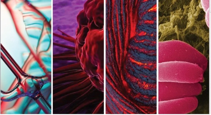 ClellandLab's tweet photo. Read our latest #research on #C9orf72, published with @SpringerNature in @SciReports. Check it out!
https://t.co/tPsPPOUN8u https://t.co/UieoDAfs20