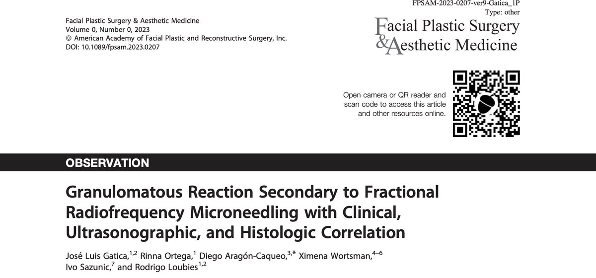First report on granulomatous reaction secondary to fractional radiofrequency microneedling with clinical, ultrasonographic and histologic correlation. Rare complication. Learn how to diagnose and manage #dermatologicultrasound #aesthetics #ultrasound pubmed.ncbi.nlm.nih.gov/38301130/