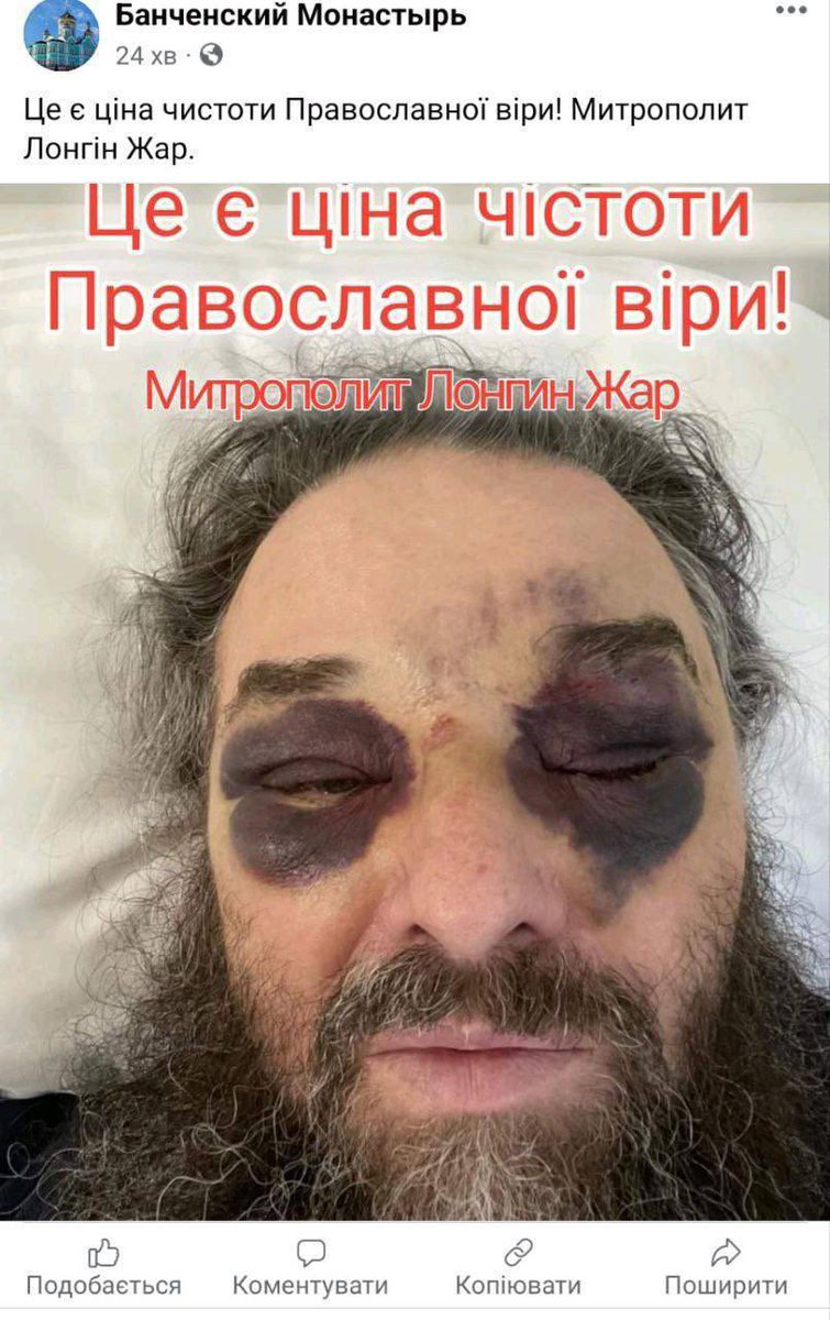 karpov16's tweet photo. Il y a un mois, les partisans 🇺🇦 d’une «église orthodoxe pure» dans les #Carpates ont brûlé la maison du père Longin, l’Abbé, métropolite du Patriarcat de Moscou, celui qui a adopté plus de 400 enfants orphelins en #Ukraine
Aujourd’hui on a essayé de le tuer!
#ZelenskyWar https://t.co/v7BG51UjQ1