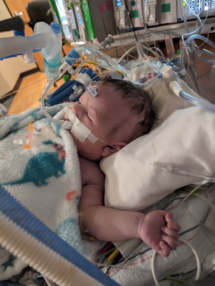 Hello, friends. We are so pleased to report that Gus had a relatively great day today! He's sleeping now, but we've seen a lot of those sweet, piercing eyes today. We're so thankful for the progress we've seen since coming off ECMO support on Saturday. Still, big hurdles remain.