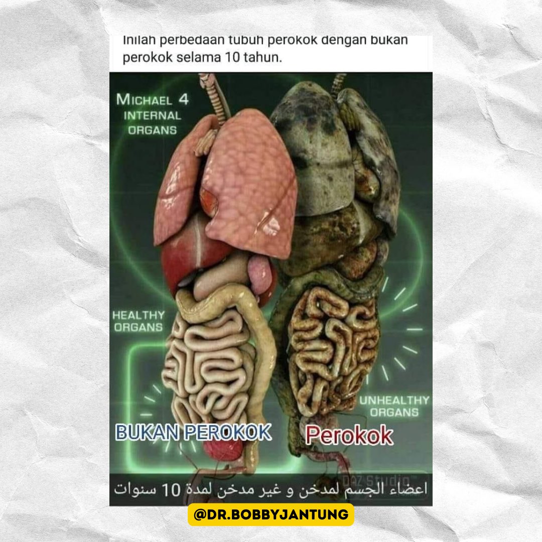 Jika wajah yg terkena debu dan asap di jalan saja bisa kusam dan kotor apalagi organ dalam yg tiap hari di asap-kan. Hawa panas dari asap rokok bercampur dengan 4000 zat kimia yg ada didalamnya akan menyebabkan peradangan disepanjang saluran nafas dan juga cerna.