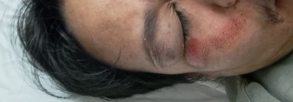 Worst office seizure hit I've had.