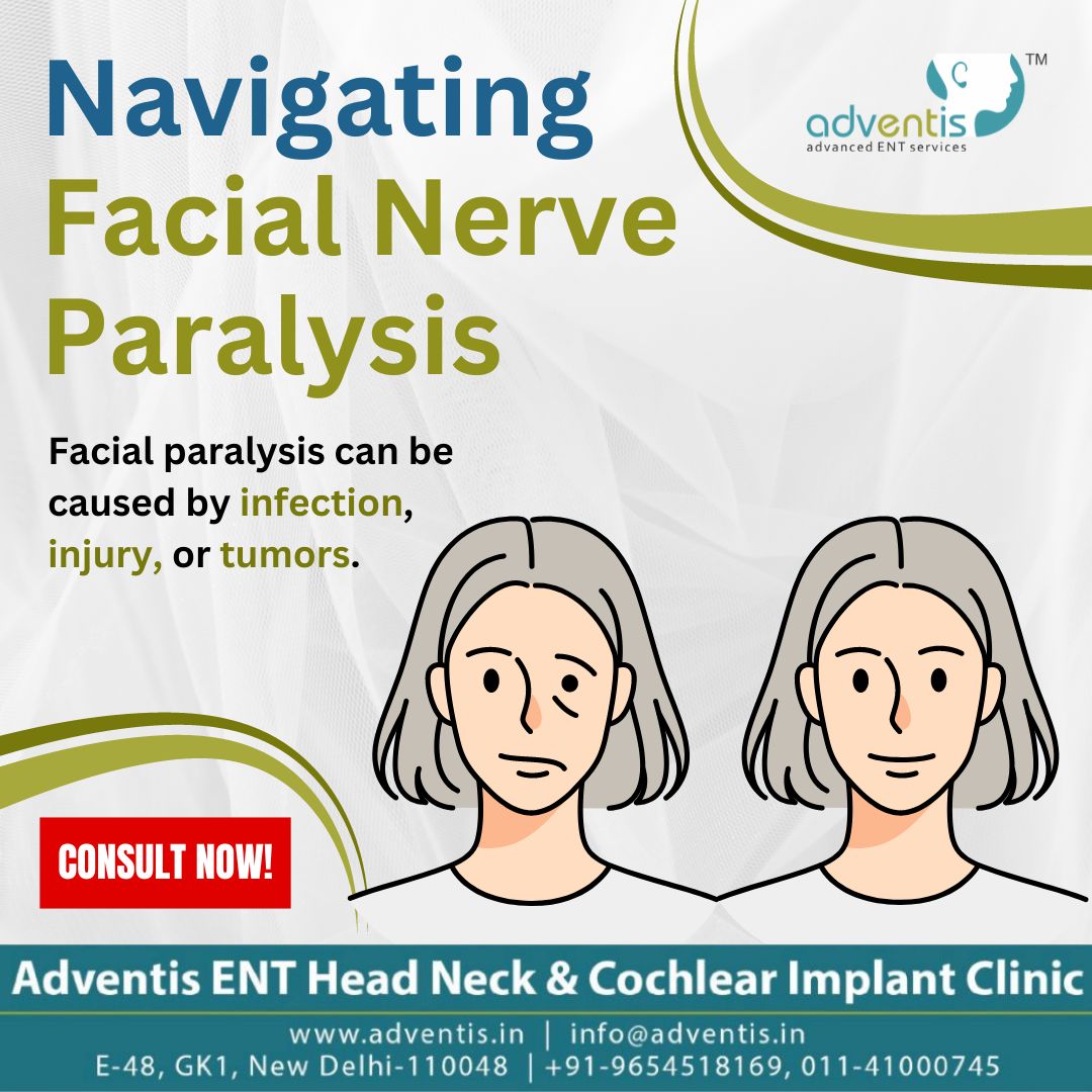 Suffering from facial paralysis? Adventis Clinic provides expert care. Our neuro-otologists diagnose the cause—be it infection, injury, or tumors—and recommend the best treatment.
🔗bit.ly/3uqQ1Mv
#AdventisClinic #AdventisENT #facialnerveparalysis #facialpalsy #facial
