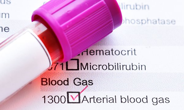 Arterial blood gas (ABG) analysis is a fundamental skill in healthcare practice, particularly when caring for acutely unwell or deteriorating patients.

This article outlines a simplified approach to ABG analysis using the RoMe technique.

journals.rcni.com/nursing-standa…