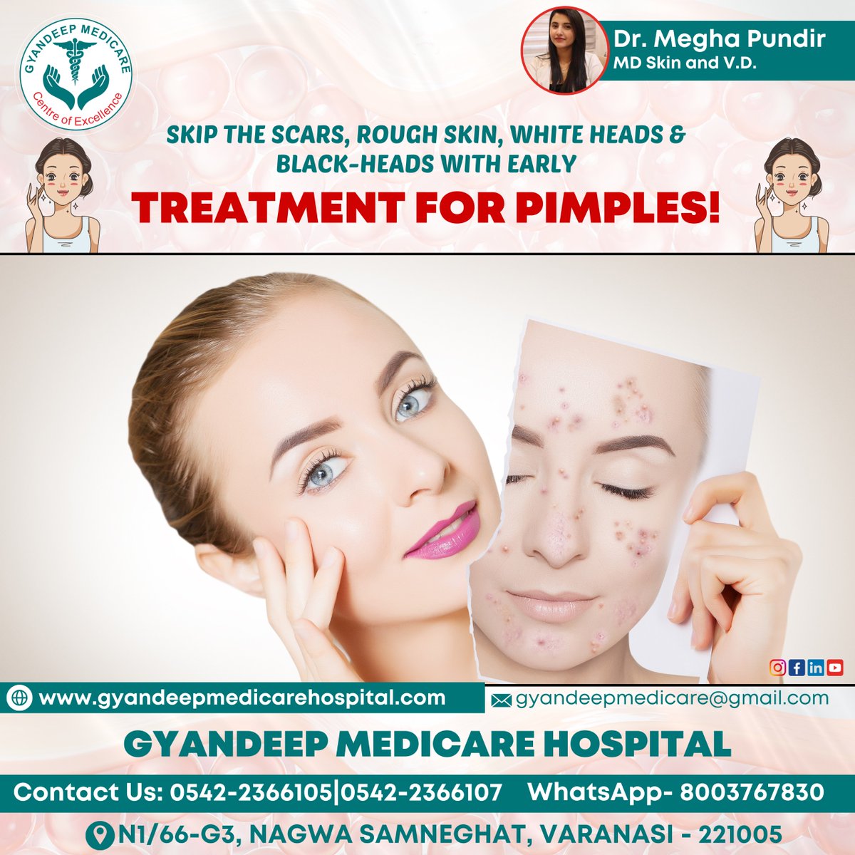 GyanDeep0001's tweet image. 🌟✨ Struggling with pesky pimples? Say hello to clearer skin with  GyanDeep Medicare! ✨🌟

:
:
#PimpleProblems
#BreakoutBlues
#AcneWoes
#ZitZapper
#ClearSkinJourney
#BlemishBattle
#PimplePanic
#SpotTreatment
#SkinStruggles
#PimplePatrol
#AcneAttack
#FlawlessFaceGoals