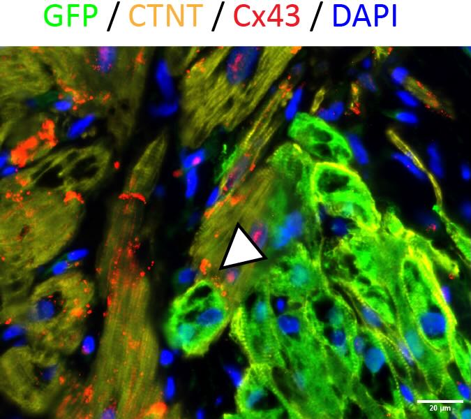 Excited to share our work on Pluripotent Stem Cell Cardiomyocyte graft arrhythmias just published in @NatureCVR nature.com/articles/s4416… Great team effort over many years particularly by first authors @dinukumar88 and @claytonzed 🙌 @WestmeadInst @syd_health @WARC_USYD