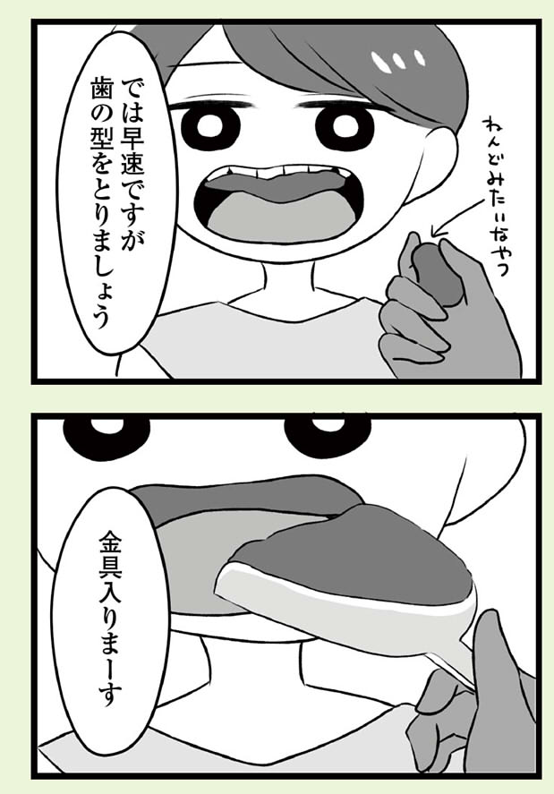 自分を好きになるために歯列矯正をして歯並びを治す話⑩ 8本抜歯編(4/5) 