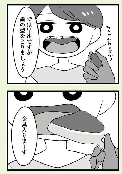 自分を好きになるために歯列矯正をして歯並びを治す話⑩ 8本抜歯編(4/5) 