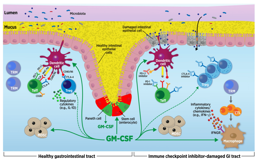 Cancers_MDPI's tweet image. 🧐Check out the #Review “Sargramostim for Prophylactic Management of Gastrointestinal Immune-Related Adverse Events of Immune Checkpoint Inhibitor Therapy for Cancer” 
📜Read more here: mdpi.com/2072-6694/16/3… 
#sargramostim #GMCSF #irAE