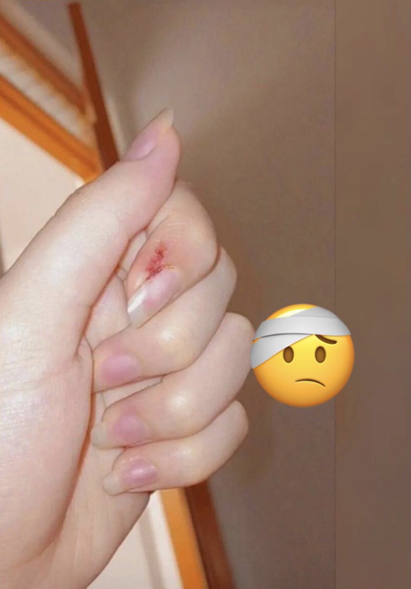 حرارة جسمي مرتفعه جدا واعطس كثير وادوخ هل هذا هو الحب ؟! 😭💔