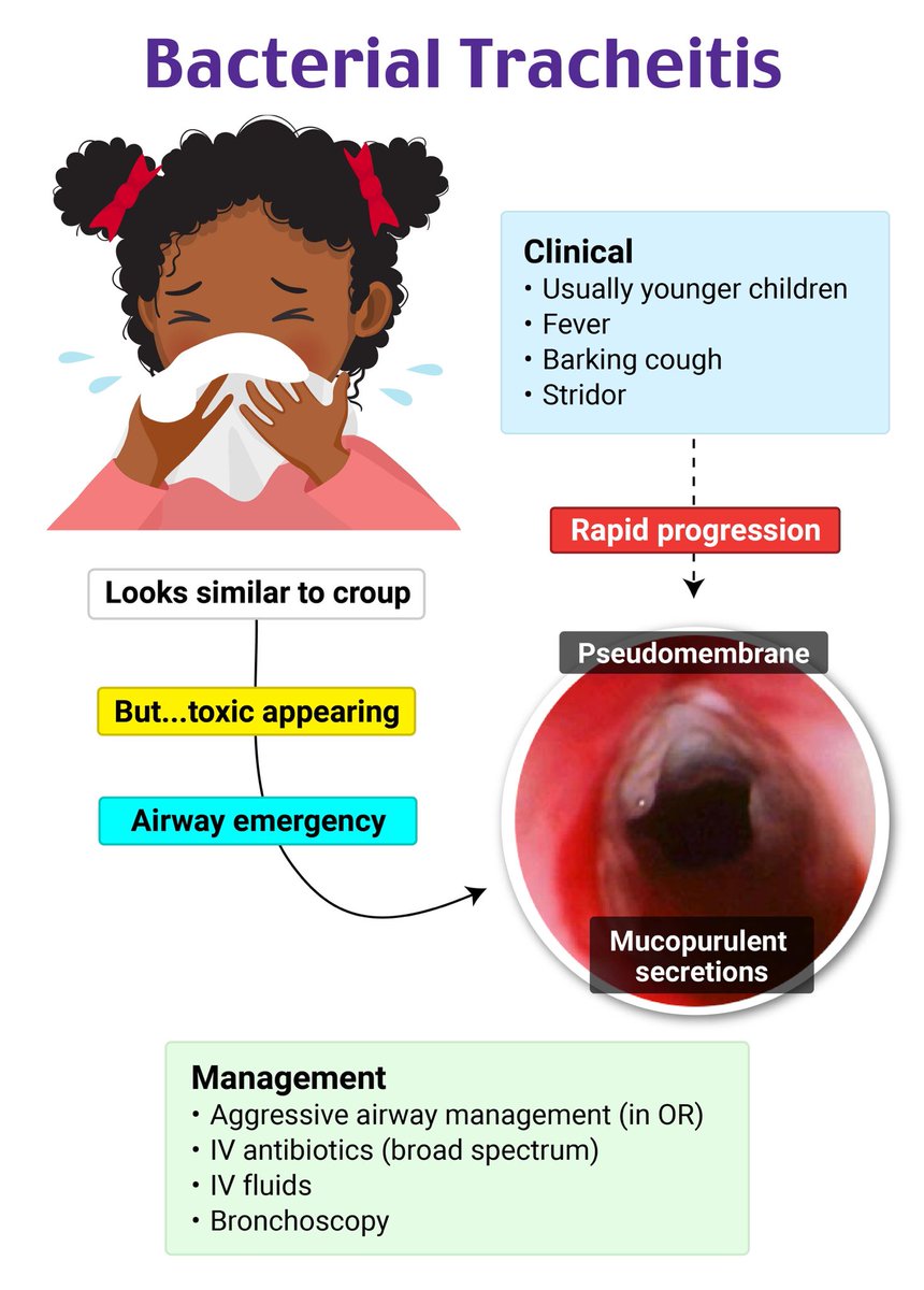 Bacterial Tracheitis 📖 By: Rosh Review #Pediatric #ENT