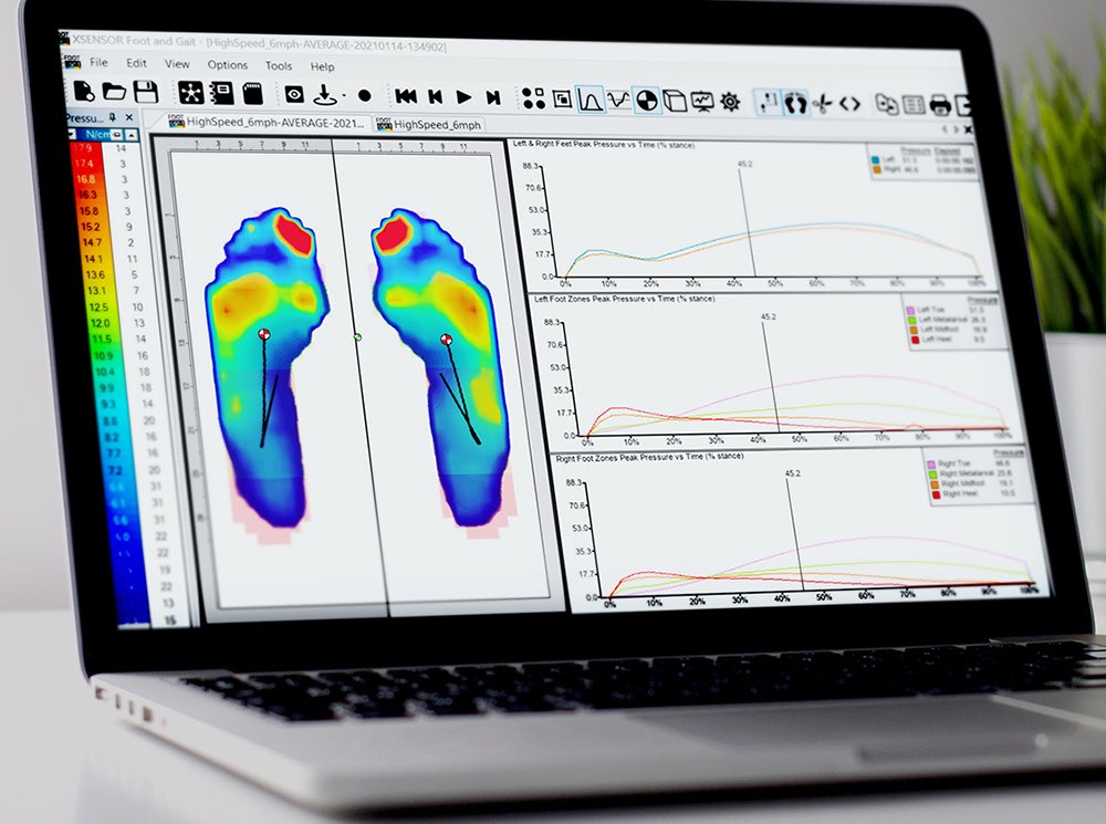 PT__world's tweet photo. “FREE Webinar with Certificate of Attendance”

Sports Performance Science  

(How to Improve Human Performance &amp; Return to Play With Plantar Pressure Data Analysis)

Register now: https://t.co/kXKWIA8r7I https://t.co/RuCMXRMqen