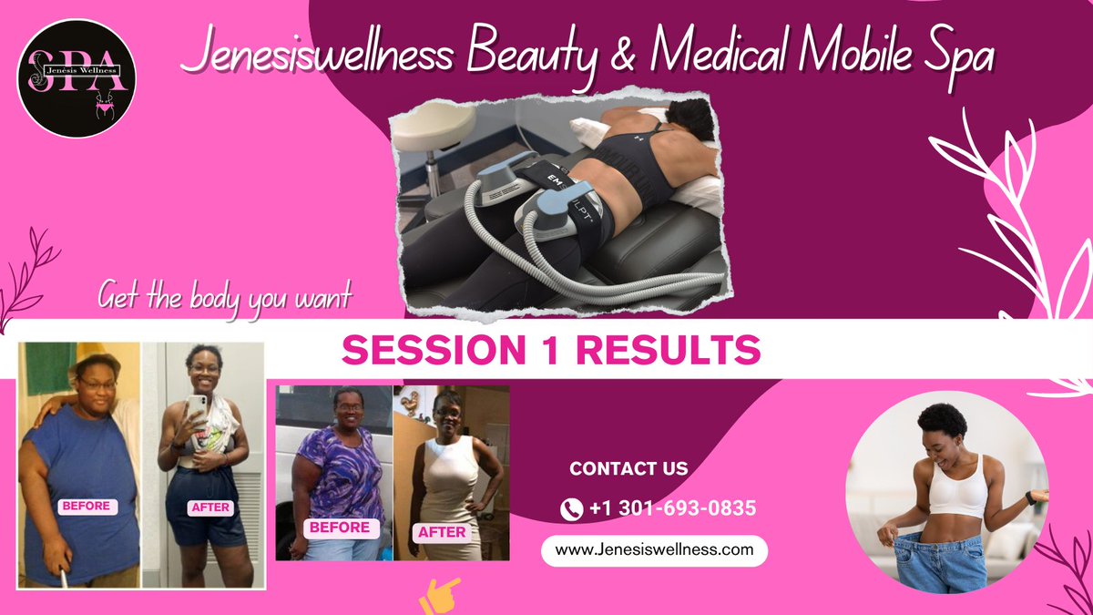 Angel93006's tweet photo. "Your journey to weight loss starts here and now! JenesisWellness Medical and Beauty Mobile Spa introduces EMSculpting and EMSZero
#weight
#weightlose
#emszero
#emsculpt
#coolsculpt
Cell # +1 301-693-0835
📍Location, Washington is located near Tantallon, Washington DC https://t.co/bfMaVKifen