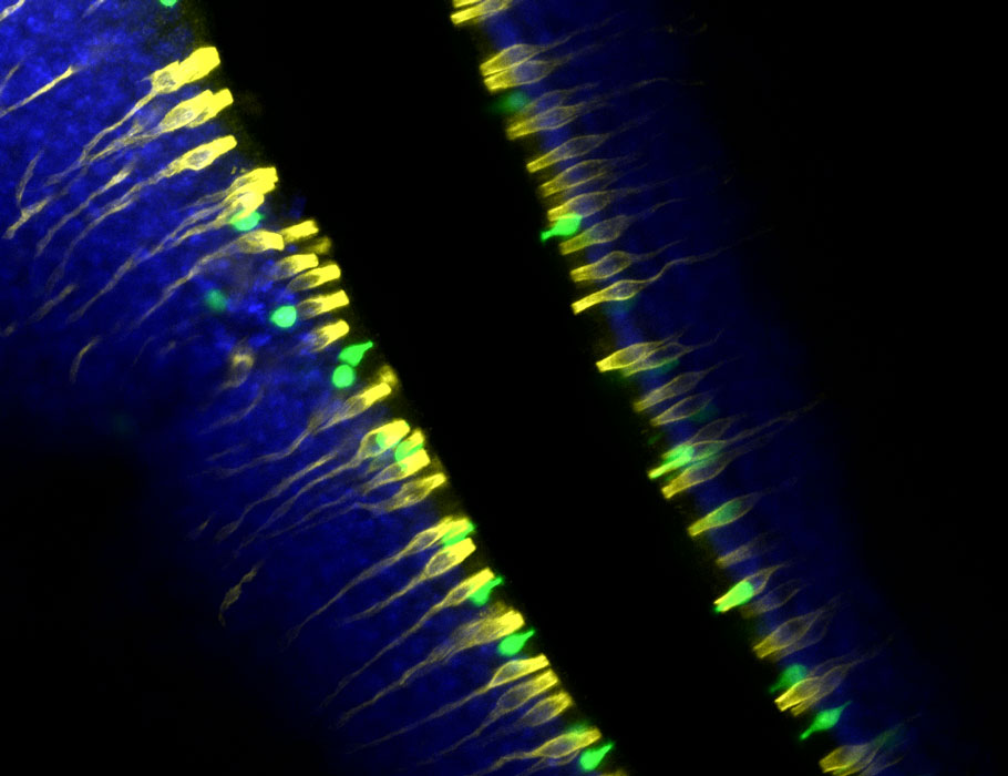 Science Immunology (@sciimmunology) on Twitter photo An atlas of the nasal mucosa in mice describes three #TuftCell populations, two of which were previously annotated differently and a third which had not yet been defined. <a href="/BrighamWomens/">Brigham and Women's Hospital</a> <a href="/BankovaLora/">Lora Bankova</a>
scim.ag/5LY An atlas of the nasal mucosa in mice describes three #TuftCell populations, two of which were previously annotated differently and a third which had not yet been defined. <a href="/BrighamWomens/">Brigham and Women's Hospital</a> <a href="/BankovaLora/">Lora Bankova</a>
scim.ag/5LY