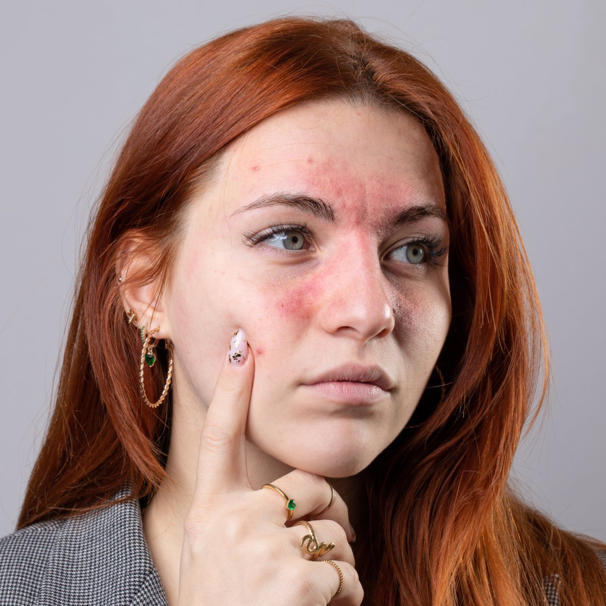 Battling eczema? Cold, dry weather can trigger flare-ups. Identify your triggers, like clothing or soaps, to manage them better. 

Track symptoms and visit PharmaChoice for expert advice from a pharmacist on products to help support your skin. #EczemaManagement