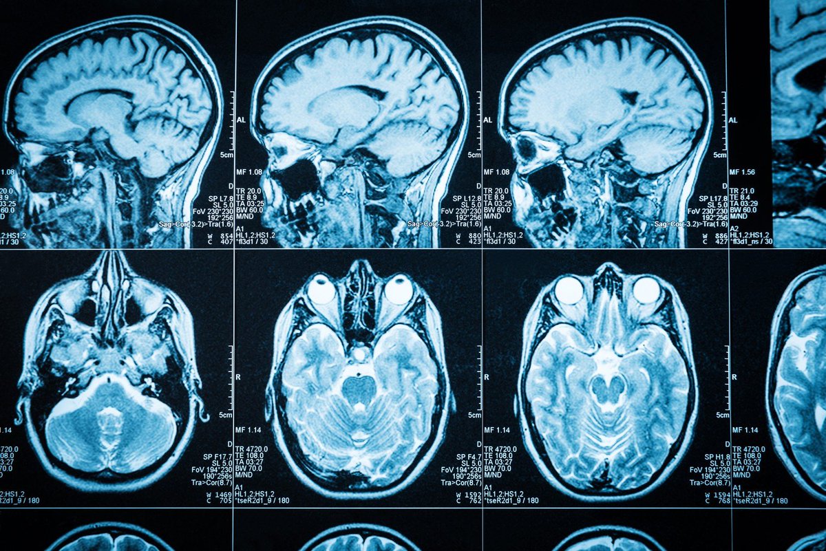 Glasgow Brain Injury Research Group (@glasgowtbi) on Twitter photo Want to join our team?
Applications are now open (link below) for our latest Research Associate position on the exciting <a href="/TBI_REPORTER/">TBI-REPORTER</a> project!
jobs.ac.uk/job/DFU372/res… Want to join our team?
Applications are now open (link below) for our latest Research Associate position on the exciting <a href="/TBI_REPORTER/">TBI-REPORTER</a> project!
jobs.ac.uk/job/DFU372/res…