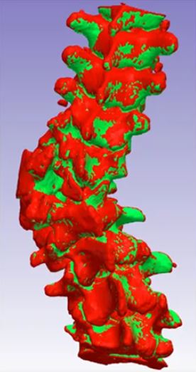 Simpleware_SNPS's tweet image. With @Simpleware_SNPS Software used in various applications for clinical 3D printing workflows, we’ve rounded up a new set of papers highlighting some of the most notable and recent examples. 👉 bit.ly/3w8WcFy | #pointofcare #medical3dprinting #anatomicalmodels