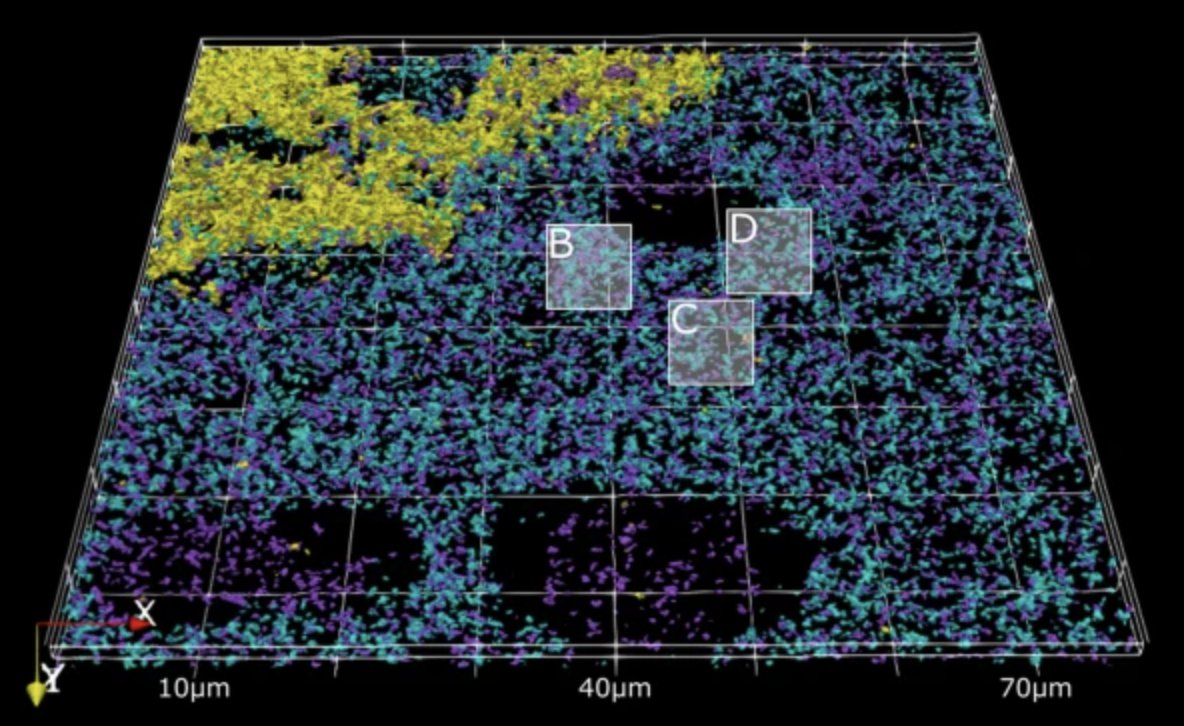 TSpiresJones's tweet photo. Yay our latest paper is out!  TMEM97 and abeta are close enough to generate a FRET signal in human synapses.  Led by amazing Dr Marti Colom-Cadena and a great collaboration with colleagues @CogRx  https://t.co/0J44IPSkwD https://t.co/TspSPz6AAZ