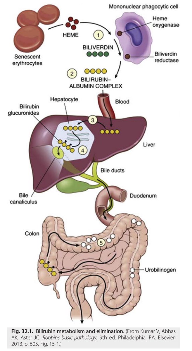 Bilirubin Metabolism and Elimination 📖 Reference: Nelson Pediatric Board Review #Pediatric #Gastroenterology