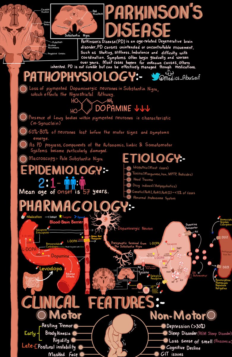 ملخصي لـ Parkinson’s Disease (الرعاش)