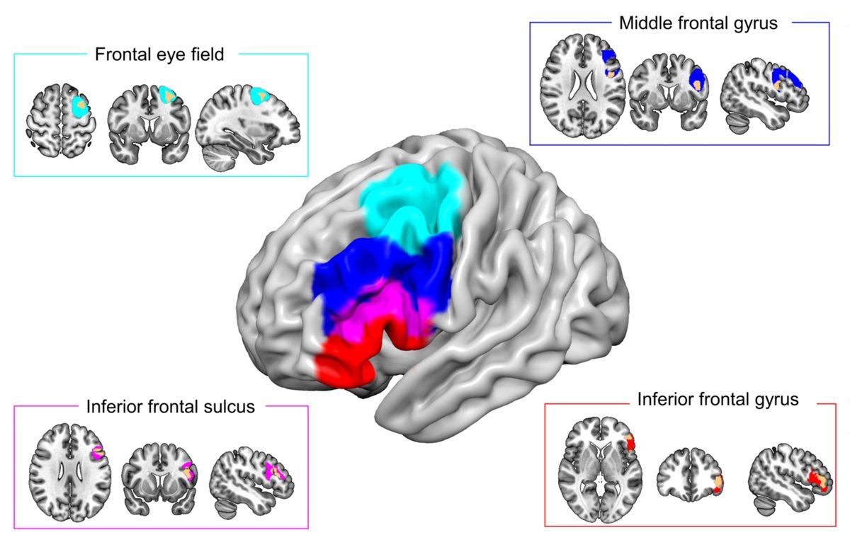 (1) Finally submitted & on bioRxiv. In this study, I collaborate with John Duncan, Beth Jefferies, & Matt Lambon Ralph to investigate how the multivariate representations of cognitive control are represented in the prefrontal cortex. #fMRI #Prefrontal biorxiv.org/content/10.110…