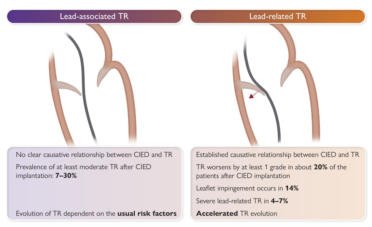 ehj_ed's tweet photo. Mechanisms, diagnostics and treatment algorithms for  cardiac implantable electronic device-related tricuspid regurgitation,  an independent clinical entity. Read more in #EHJ.
https://t.co/iR62jF3J2g
#tricuspid #pacemaker #regurgitation #cardiotwitter @ESC_Journals @escardio. https://t.co/pieVTUDBm5