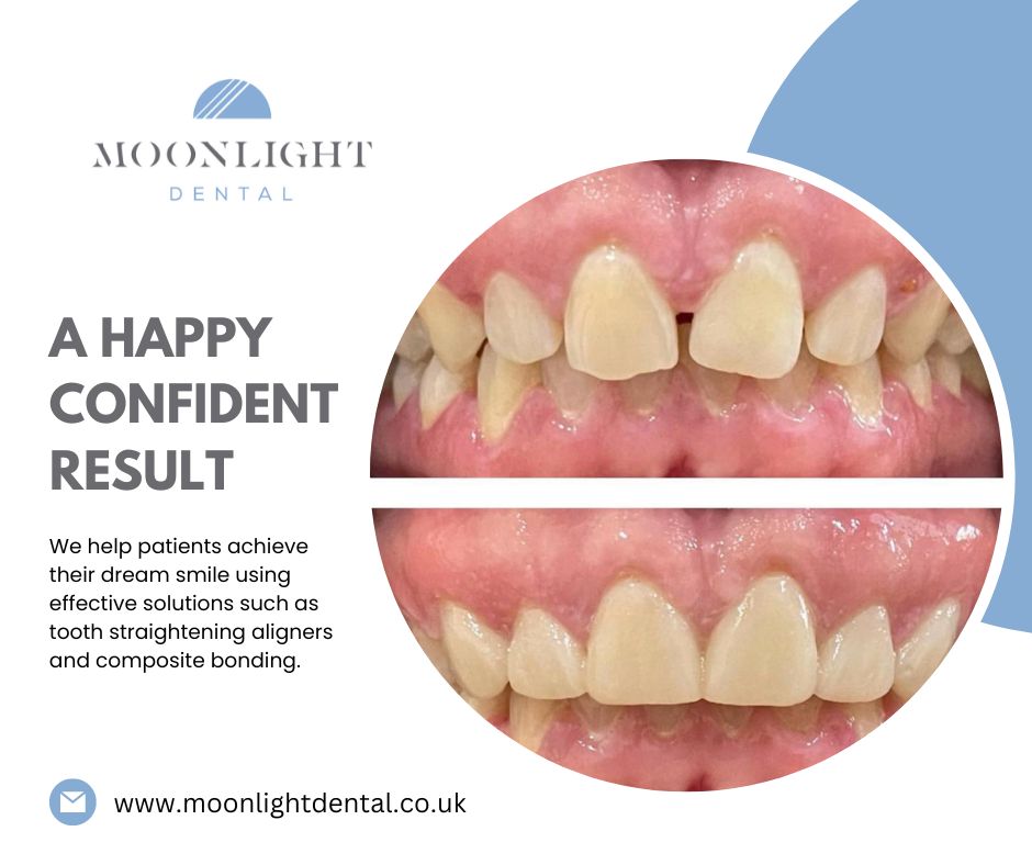 MoonlightDent's tweet photo. A happy confident smile can make the world of difference... https://t.co/r716zLX7vY