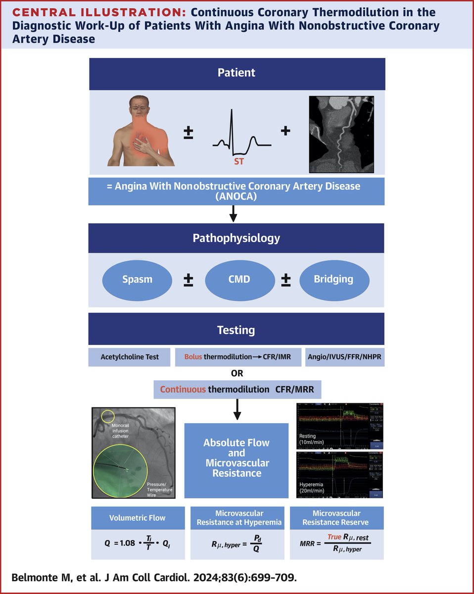 JACCJournals's tweet photo. Standardization of absolute coronary flow and microvascular resistance measurements: how to perform continuous intracoronary thermodilution https://t.co/8Eat4IGJAZ

#JACC #ANOCA @belmontemarta1 @BernardBruyne @MortonKern @MizukamiTakuya @ColletCarlos https://t.co/RNFkwc2QTd