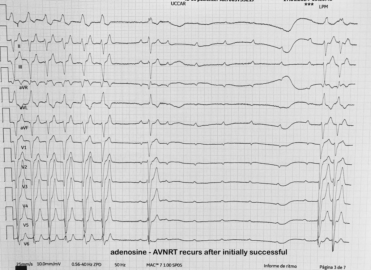 It was an incessant AVNRT Perhaps the #EKG changes and their electrophysiological properties after TAVR have favored this situation.