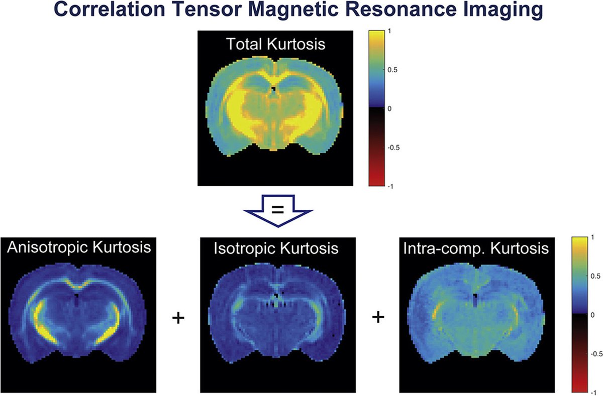 🚀 Exciting DIPY v1.8.0 update! 🎉 Introducing Correlation Tensor Imaging (CTI) - an MRI game-changer! 🧠📸 CTI, powered by Double Diffusion Encoding, unlocks diffusion kurtosis sources without modeling. Dive into advanced imaging now!🌐✨ To learn more join our online workshop