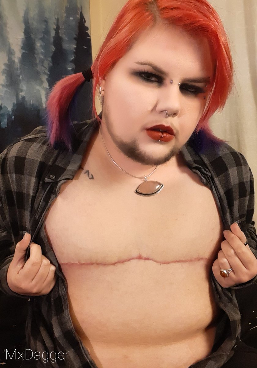 Mx_Dagger's tweet photo. 🩷Post Op Chest Reveal!🖤
I'm ready to share this with yous! I can't believe how different my shoulders &amp; belly look but I promise all that's changed is no more tits.  
Still non binary as hell, still they/them pronouns! https://t.co/avILLjzsLE