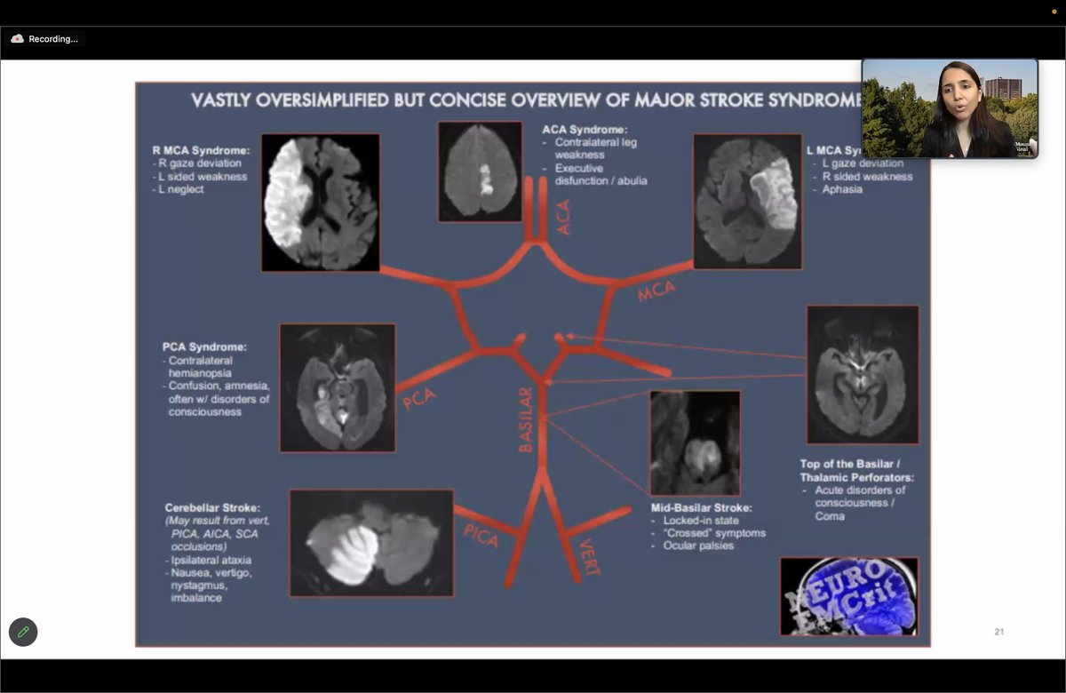 UC Riverside Critical Care Medicine (@ucrcriticalcare) on Twitter photo Thank you <a href="/drdangayach/">Neha Dangayach MD MSCR FAAN FANA FCCP FCCM FNCS</a> for a fantastic grand rounds on AIS & ELVO management. We are excited to be able to care for LVO at our center soon. Thank you <a href="/drdangayach/">Neha Dangayach MD MSCR FAAN FANA FCCP FCCM FNCS</a> for a fantastic grand rounds on AIS & ELVO management. We are excited to be able to care for LVO at our center soon.