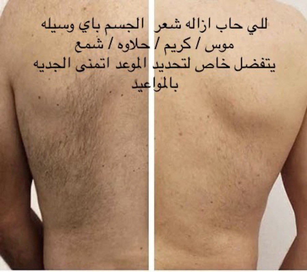 في المجمعه وماحولها فقط