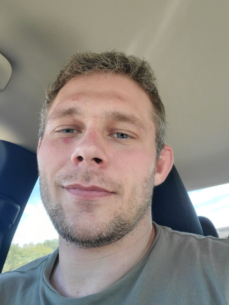 I tried to shell up, but I got my block broken. No skill spammers. 😮‍💨😮‍💨