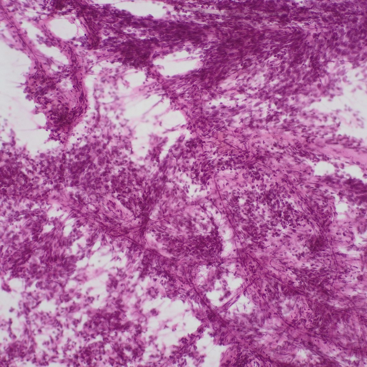 Kate Krause tweet media