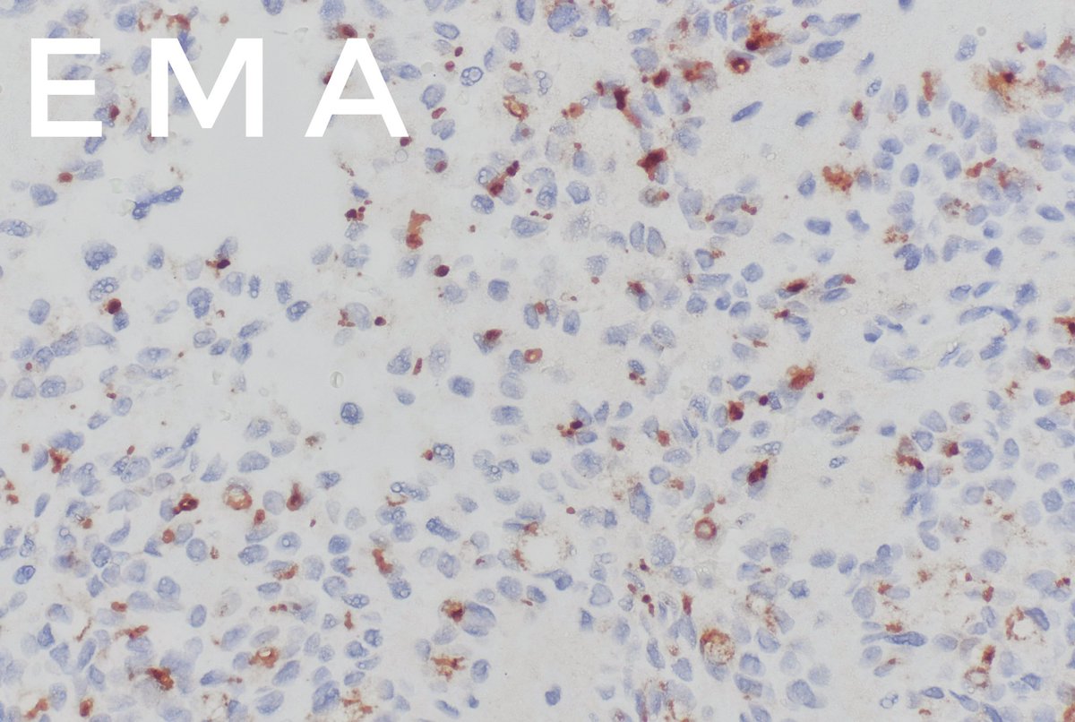 Kate Krause tweet media