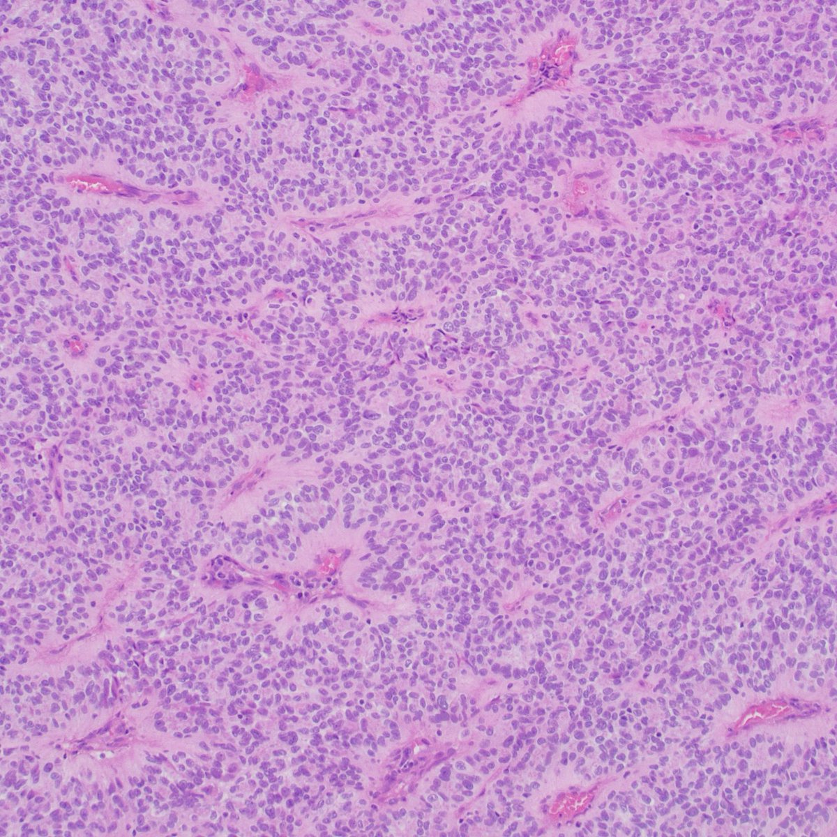 Kate Krause tweet media