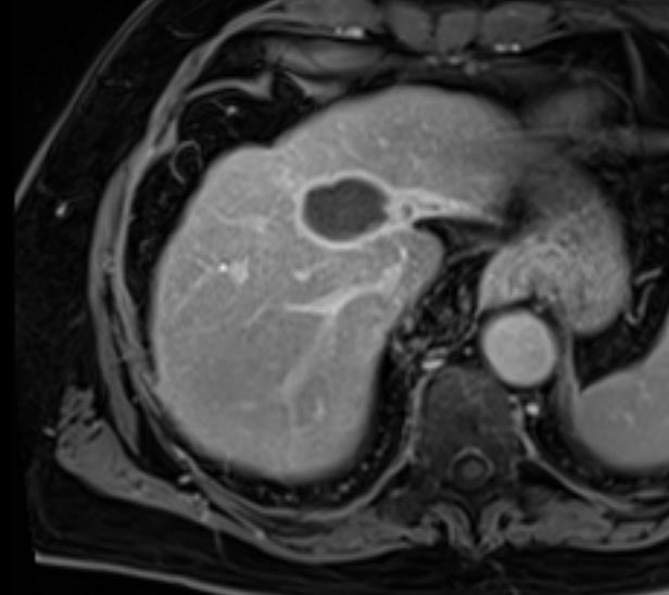 Practical review on rad seg for HCC 💥

📌 mdpi.com/2072-6694/16/3…