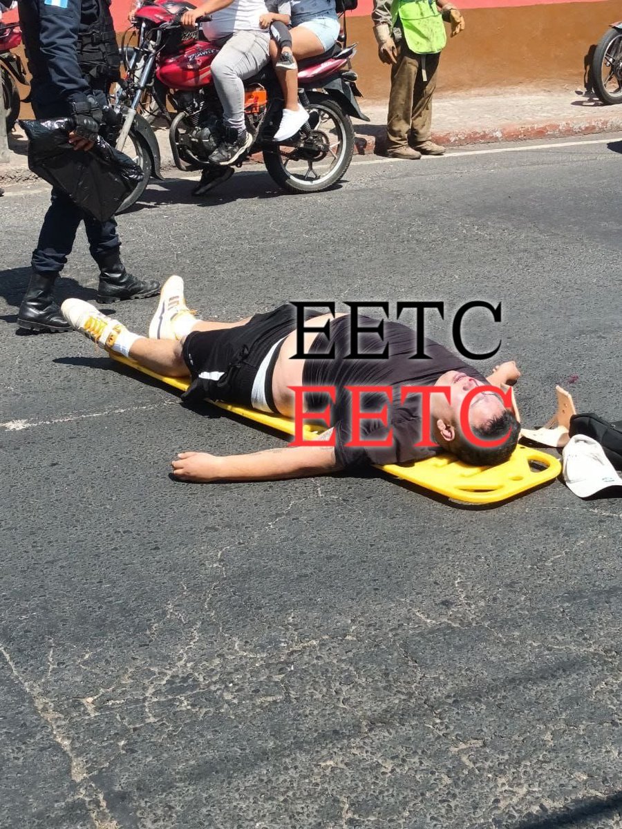 T1EETC_NOTICIAS's tweet photo. #AMPLIACION 

MOTOLADRÓN FALLECIDO EN EL HOSPITAL 

El incidente ocurrió en el sector de La Bethania, donde Ludwig Roberto Ramírez Hernández, conocido como "El Gordo", fue identificado como el presunto motoladrón que había estado cometiendo varios delitos en la zona.

Según testigos, Ludwig intentó escapar en una motocicleta tras haber cometido un robo, pero fue perseguido por un valiente piloto que, al verse amenazado, decidió usar su arma de fuego para defenderse.

En un acto de valentía, el piloto disparó a Ludwig en la cabeza, provocando su ejecución en el lugar. Las autoridades llegaron rápidamente al escenario del crimen y confirmaron la identidad del motoladrón.

Las investigaciones preliminares indican que Ludwig Roberto Ramírez Hernández era conocido en la zona por su historial delictivo, involucrado en robos a mano armada y asaltos a motociclistas.

La policía está trabajando en recopilar pruebas y testimonios para determinar si la acción del piloto fue en defensa propia y si actuó dentro del marco legal. Se espera que las autoridades revisen las cámaras de seguridad cercanas para obtener más información sobre los eventos que llevaron a la ejecución de Ludwig.

La noticia ha generado diversas reacciones en la comunidad, donde algunos celebran la valentía del piloto y consideran que se hizo justicia, mientras que otros cuestionan si el uso de un arma de fuego era la mejor forma de abordar esta situación.

Es importante recordar que las autoridades son responsables de investigar y dictaminar si hubo alguna violación de la ley en este caso. La solución a los problemas de seguridad requiere un enfoque integral que incluya tanto la prevención del delito como el cumplimiento adecuado de la ley.

Únete a nuestro canal de WhatsApp y grupo de Telegram  donde encontrarás fotos y vídeos sin censura 👇

CANAL DE WHATSAPP : https://t.co/Q7WNNFYKzL

GRUPO DE TELEGRAM:
https://t.co/QwEb1U3WD9