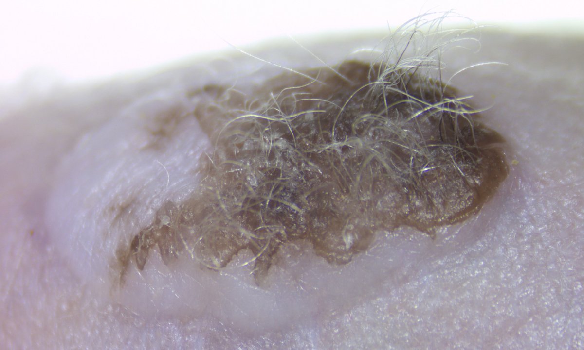 #Stemson's technological breakthrough - demonstrating engineered functional hair follicles in humanized mice #HairLoss #HairRejuvenation #StemCell