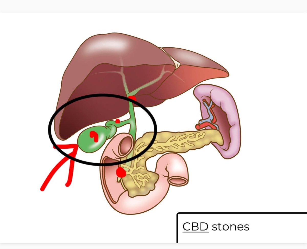 Which one would your patient prefer? Which one would you prefer? #PatientCare #EducationMatters