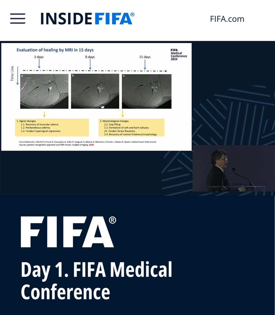 ⚽️Watching the  #fifamedicalconference live online: Dr Ricard Pruna - RTP after hamstring muscle injury - MRI has an important role predicting reinjuries - the Barcelona experience @IsernKebschull @mechomeca @akassarjian @FIFAMedical