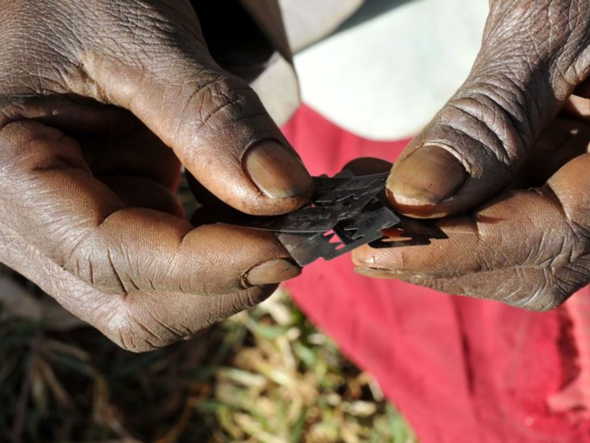 👉🏾Hoy es el Día Internacional de Tolerancia Cero con la Mutilación Genital Femenina, una práctica machista y horrorosa que ocurre en todo el mundo, incluyendo Colombia🇨🇴. 

Consiste en mutilar los genitales de mujeres y niñas. Existen tres tipos (🚨ojo que es fuerte):