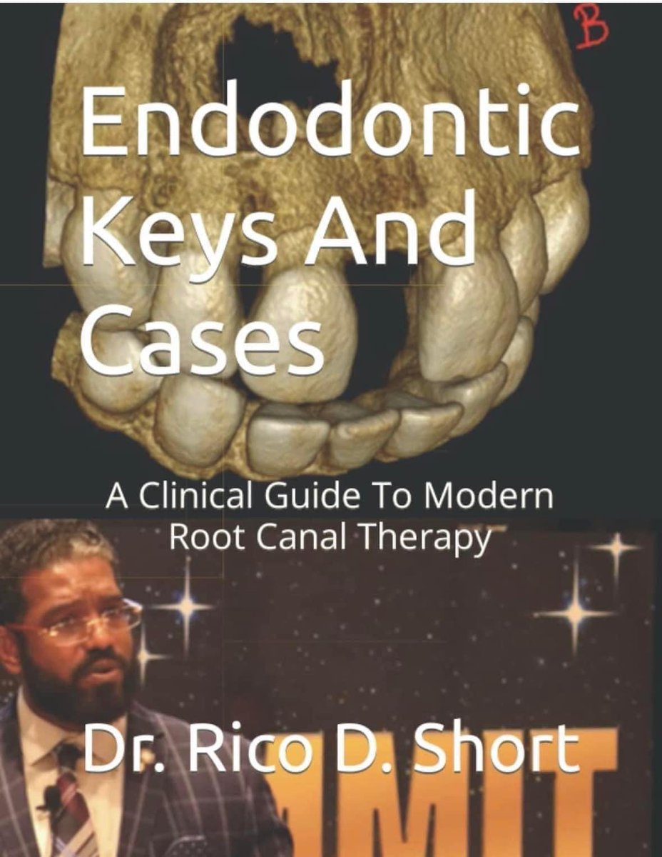 DrRicoShort's tweet photo. Where Is The Pathology?
Oh I found it with CBCT Technology!
Case was retreated and healed. #drricoshort #dentistry #endodontics #retreatment #endodontickeysandcases https://t.co/dJlW32bxFs