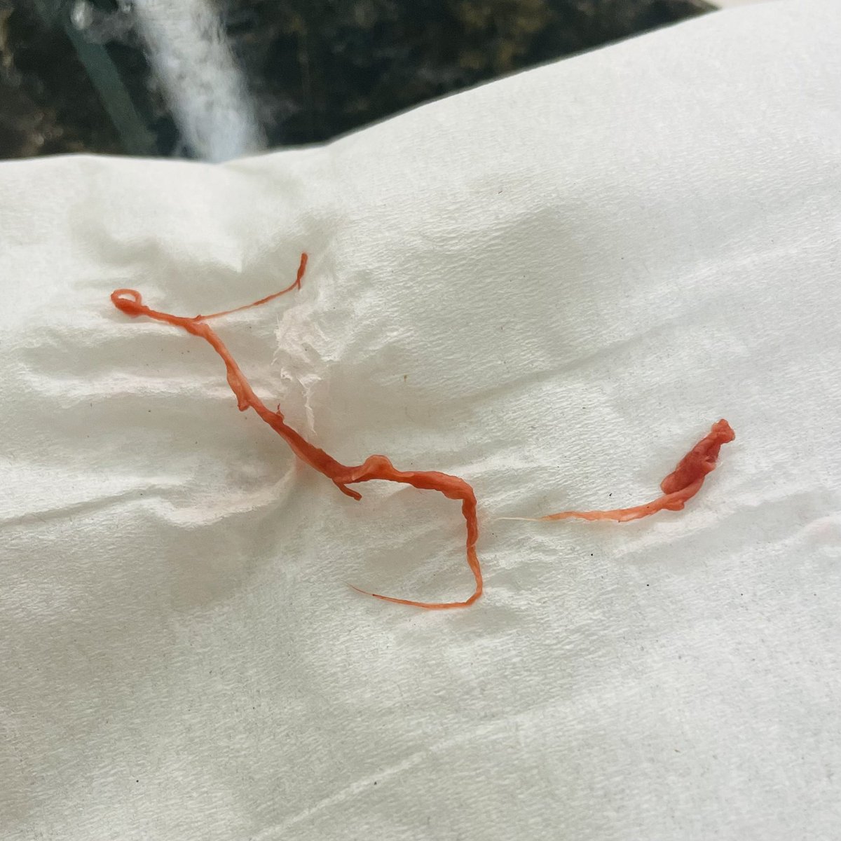 Hey <a href="/Gatorade/">Gatorade</a>! I love your delicious beverages and appreciate all the electrolytes you include in each bottle…

But I don’t appreciate this bonus ingredient in the last bottle I tried to drink.

Can you shed some light on what you think it is so I know how grossed out to be?