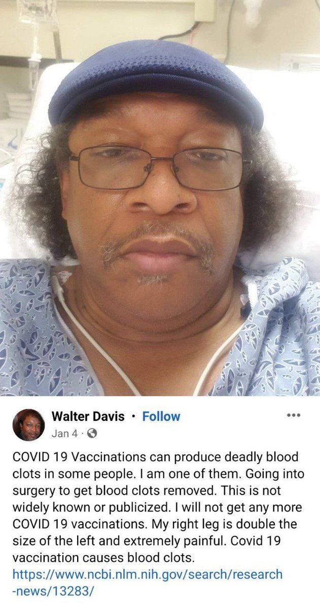 Poor guy… “COVID 19 Vaccinations can produce deadly blood clots in some people. I am one of them. Going into surgery to get blood clots removed. This is not widely known or publicized. I will not get any more COVID 19 vaccinations. My right leg is double the size of the left