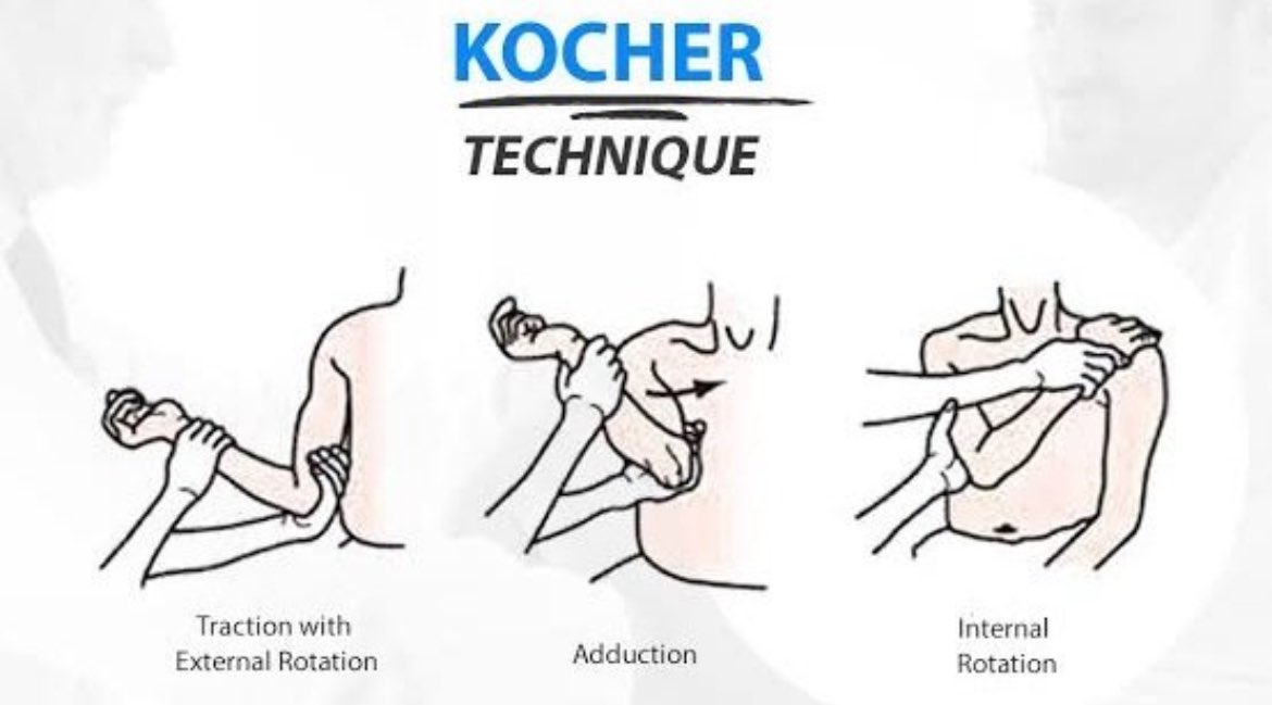The kocher technique for shoulder reductions is the oldest described technique with one Egyptian wall painting dating back to 1200 BC.

#MedTwitter #MedEd