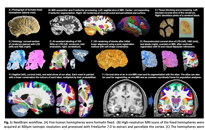 ParkvilleGeek's tweet photo. A next-generation, histological atlas of the human brain and its application to automated brain MRI segmentation | bioRxiv https://t.co/5NySKWM2Or https://t.co/OEzfEJQ2fw