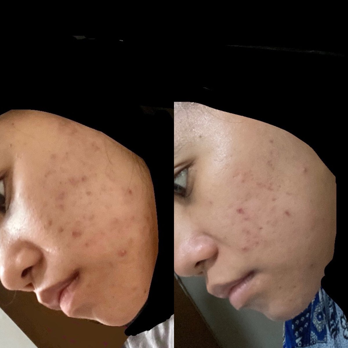 Ivani Light tweet media